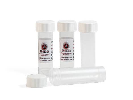 Tek-Select Prefilled Formalin Vials