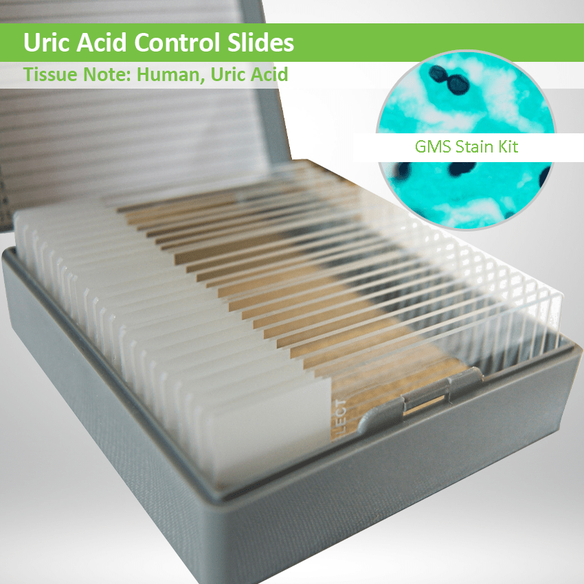 Uric Acid Control Slide Set