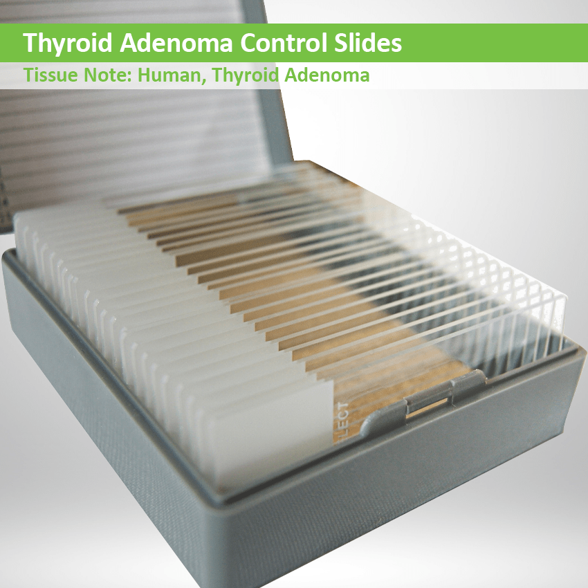 Thyroid Adenoma Control Slide Set
