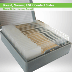 Breast Control Slides Normal EGFR