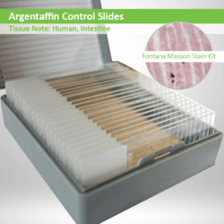 Argentaffin Control Slides