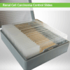 Renal Cell Carcinoma Control Slide Set