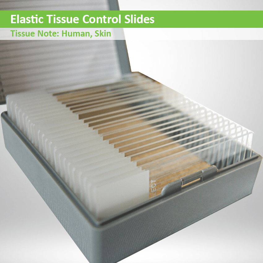 Elastic Control Slides CS011