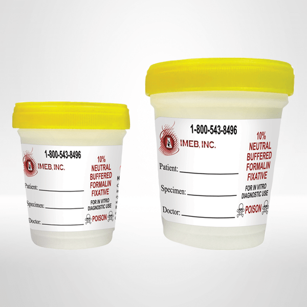 10 percent buffered formalin in large prefilled containers with a yellow lid