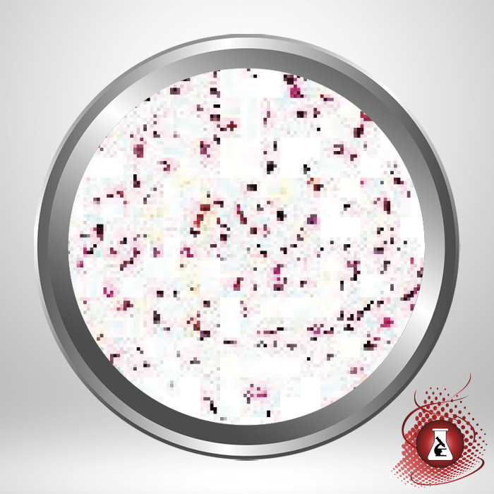 K7608 Congo Red-Amyloid Stain Kit