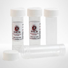 750 mL buffered formalin