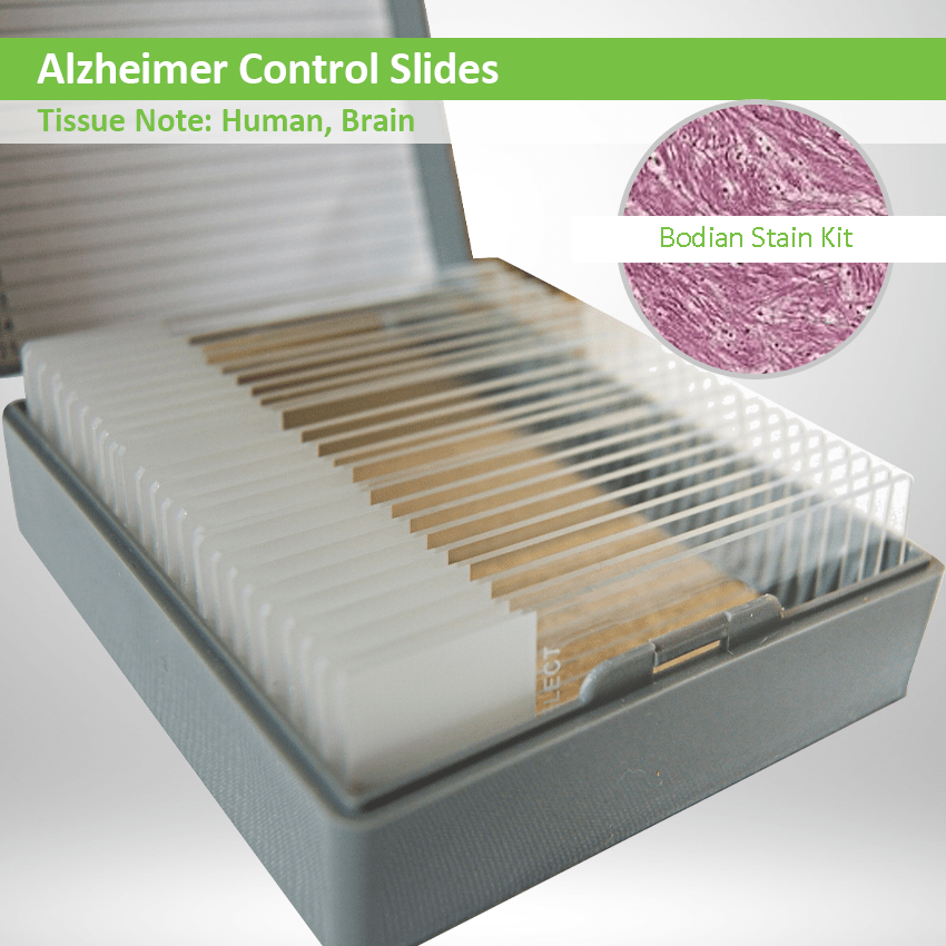Alzheimer Control Slides