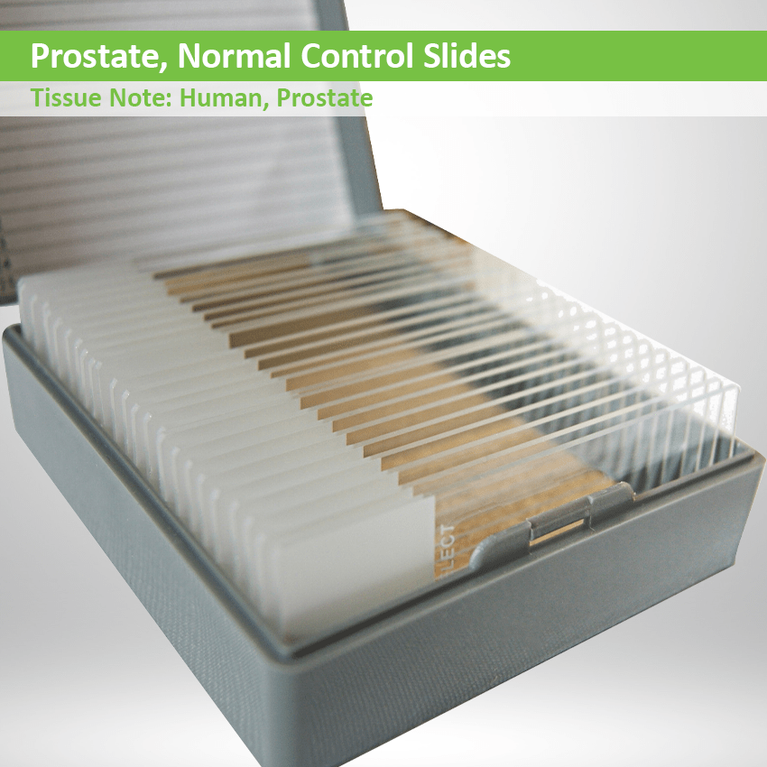 Prostate Normal Control Slide Set