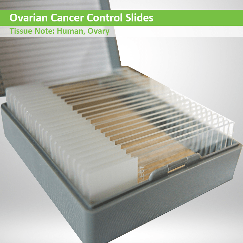 Ovarian Control Slides