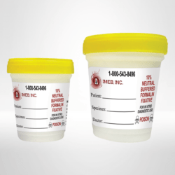 10 percent buffered formalin in large prefilled containers with a yellow lid