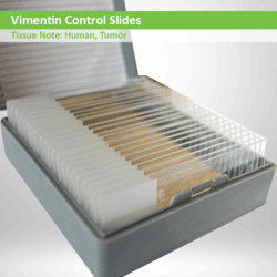 Vimentin Control Slide Set