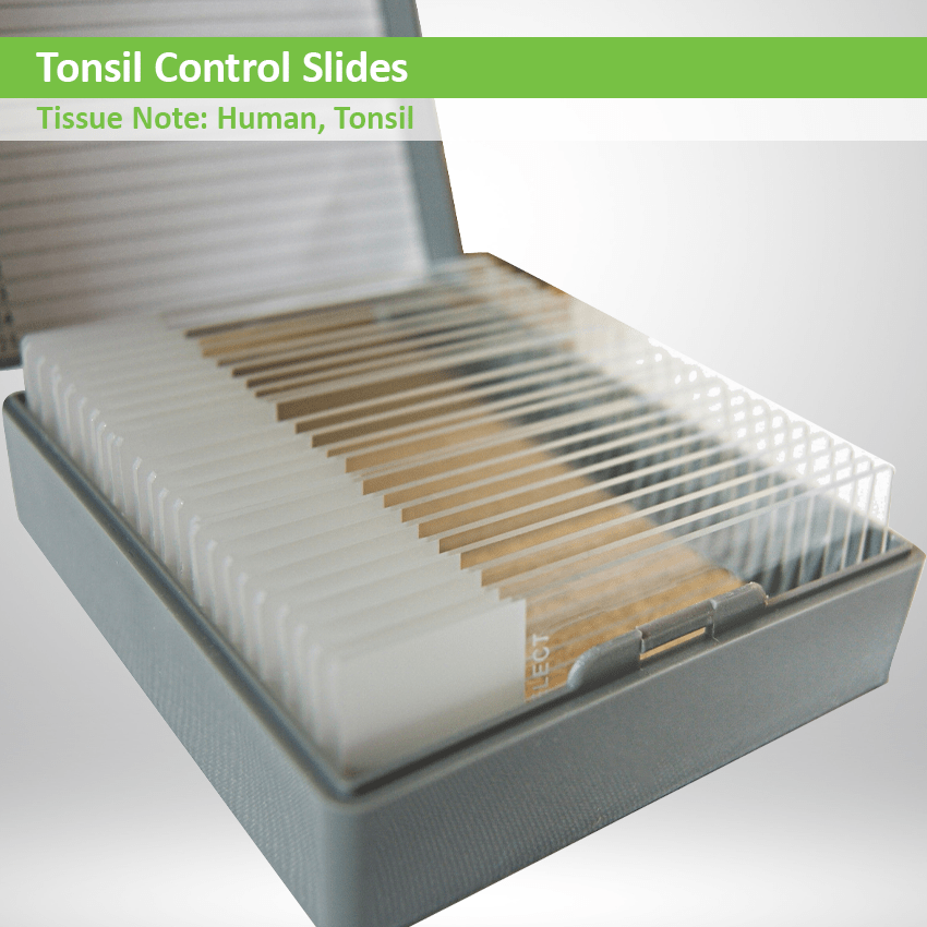 Tonsil Control Slide Set