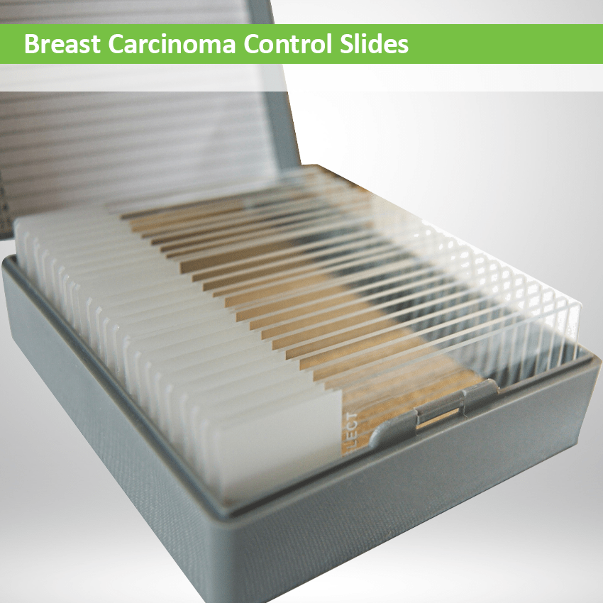 Control Slides Breast Carcinoma