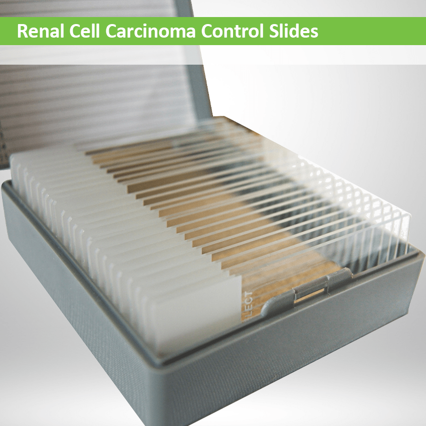 Renal Cell Carcinoma Control Slide Set