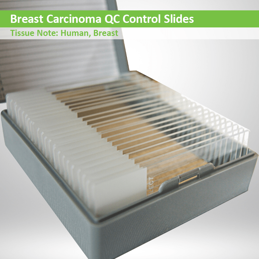Breast Carcinoma QC Control Slide Set