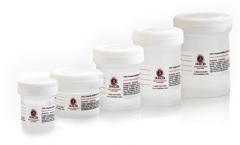 Polypropylene Prefilled 10% Formalin Containers 1/2oz